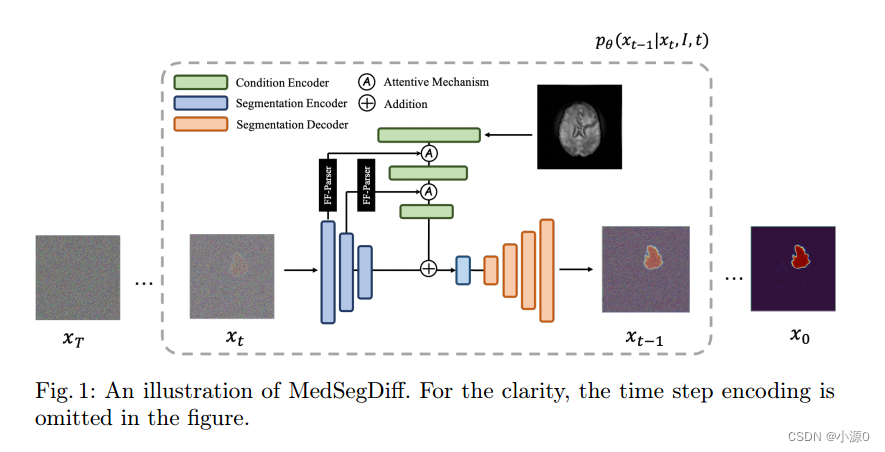 论文阅读：MedSegDiff: Medical Image Segmentation with Diffusion Probabilistic Model