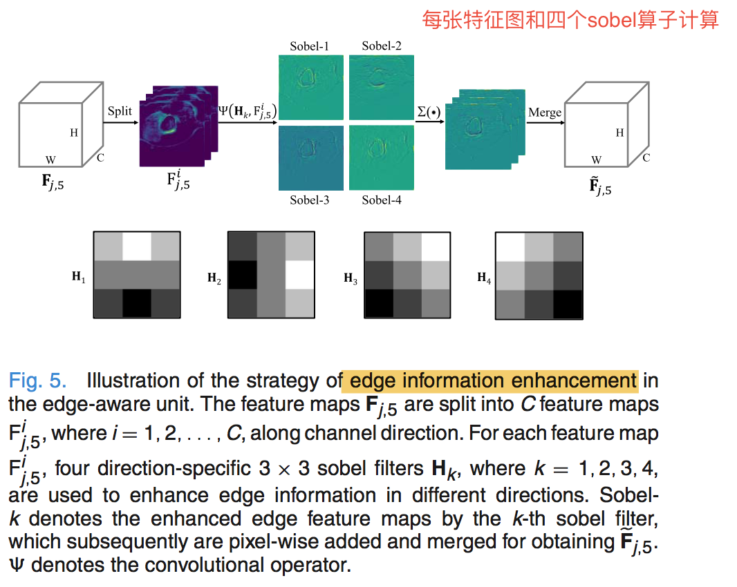 医学论文笔记：TMI2021 SMU-Net: Saliency-Guided Morphology-Aware U-Net For ...