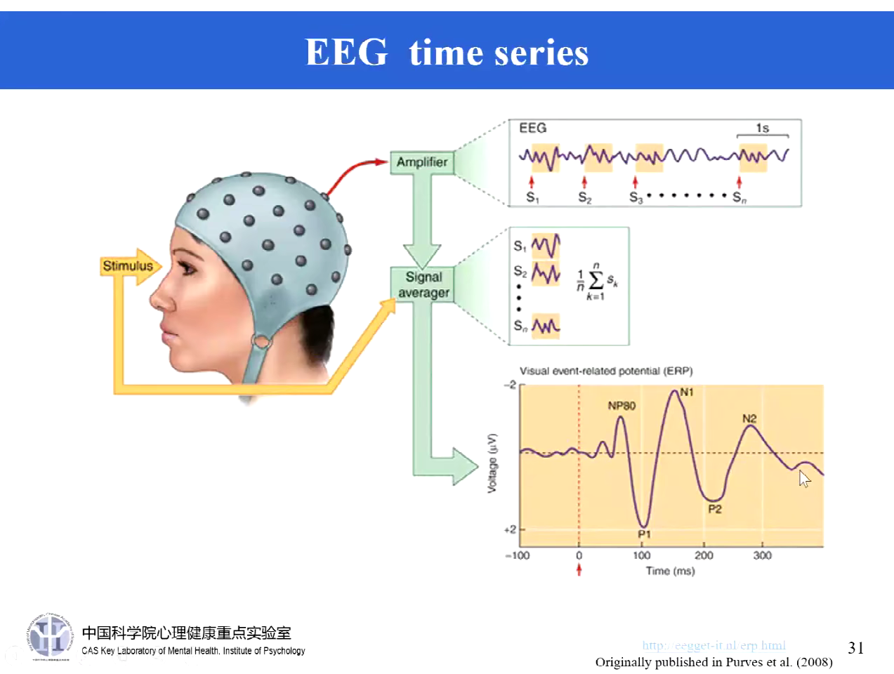 egi脑电图片