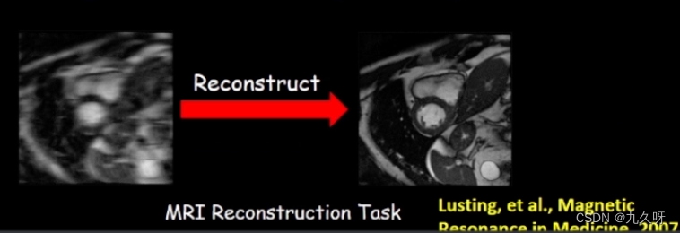 MRI Reconstruction Task