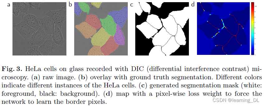 《u Net Convolutional Networks For Biomedicalimage Segmentation》笔记olaf Ronneberger Philipp