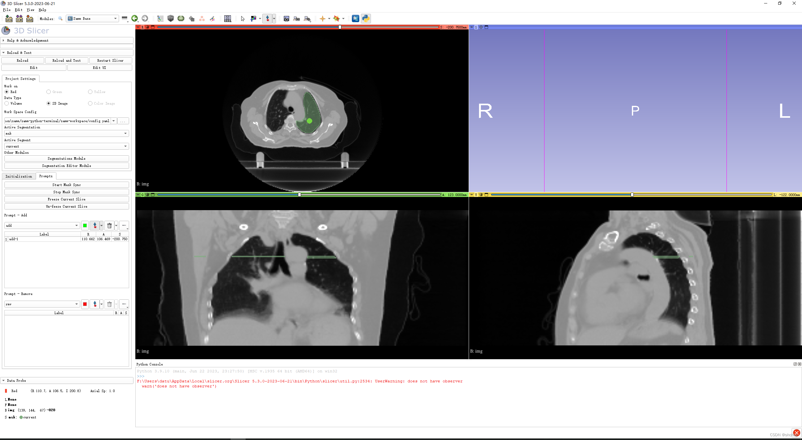 Segment Any Medical-Model (SAMM)在3D slicer上部署