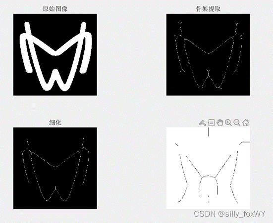 matlab图像形态学运算-膨胀，腐蚀，开闭运算，骨架提取细化_形态学处理matlab-CSDN博客