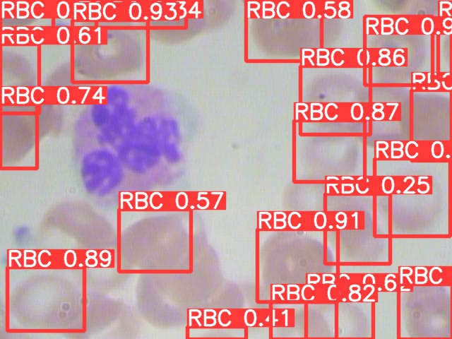 【目标检测】基于yolov5的红细胞检测和计数(附代码和数据集，Ubuntu系统)