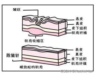 棕榈酰三肽-38——对额间纹，鱼尾纹，抬头纹和颈纹非常有效