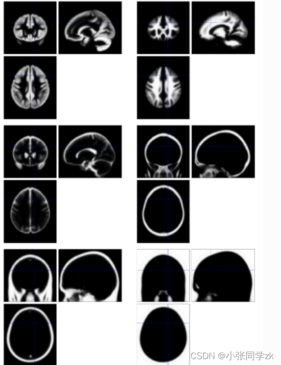 基于Spm12对fMRI数据的分析（超详细）-CSDN博客