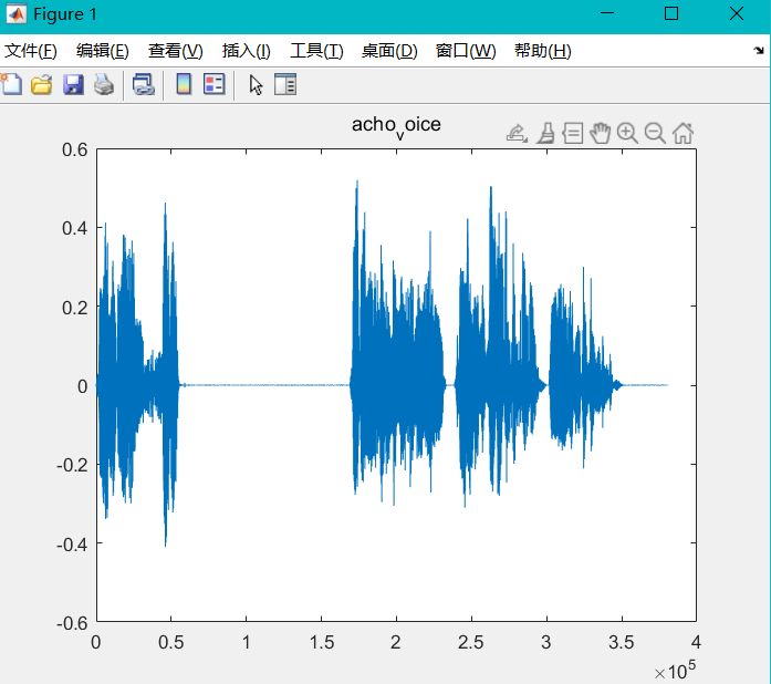 使用Matlab实现消除音频信号中的回声信号_使用matlab消除回声-CSDN博客