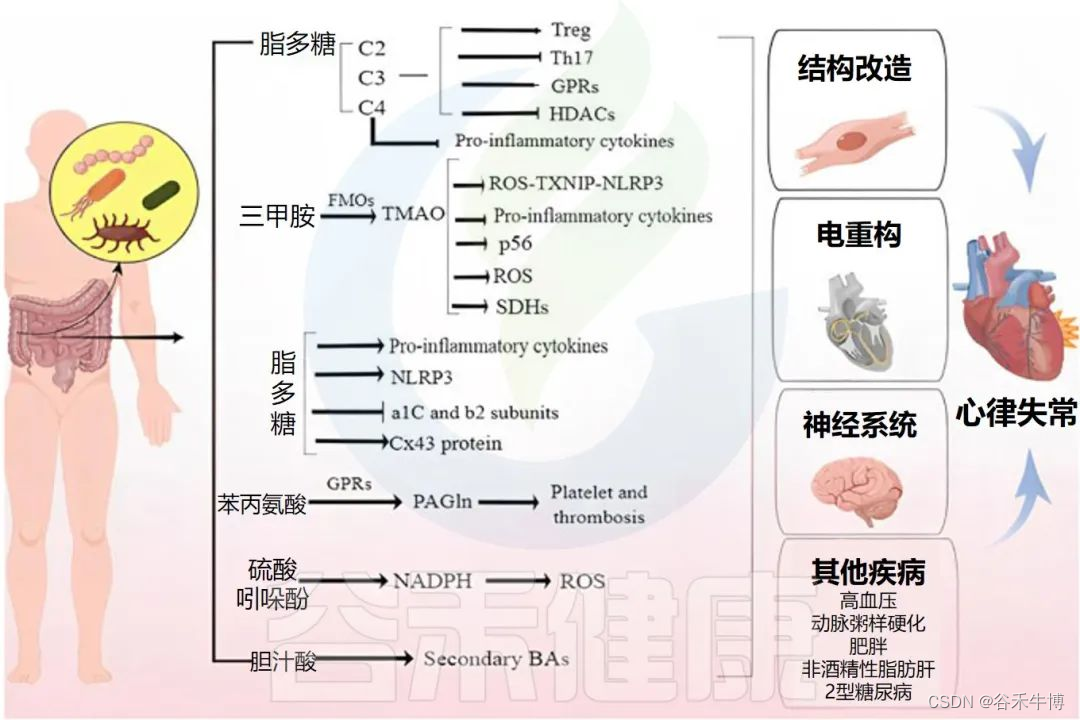 探索心律失常：病因、诊断与治疗以及与肠道菌群的关联