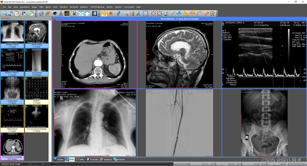 free downloads Sante DICOM Viewer Pro 14.0.1