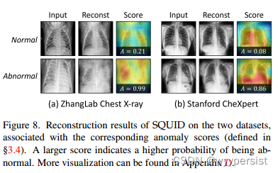 《SQUID: Deep Feature In-Painting for Unsupervised Anomaly Detection》论文阅读理解