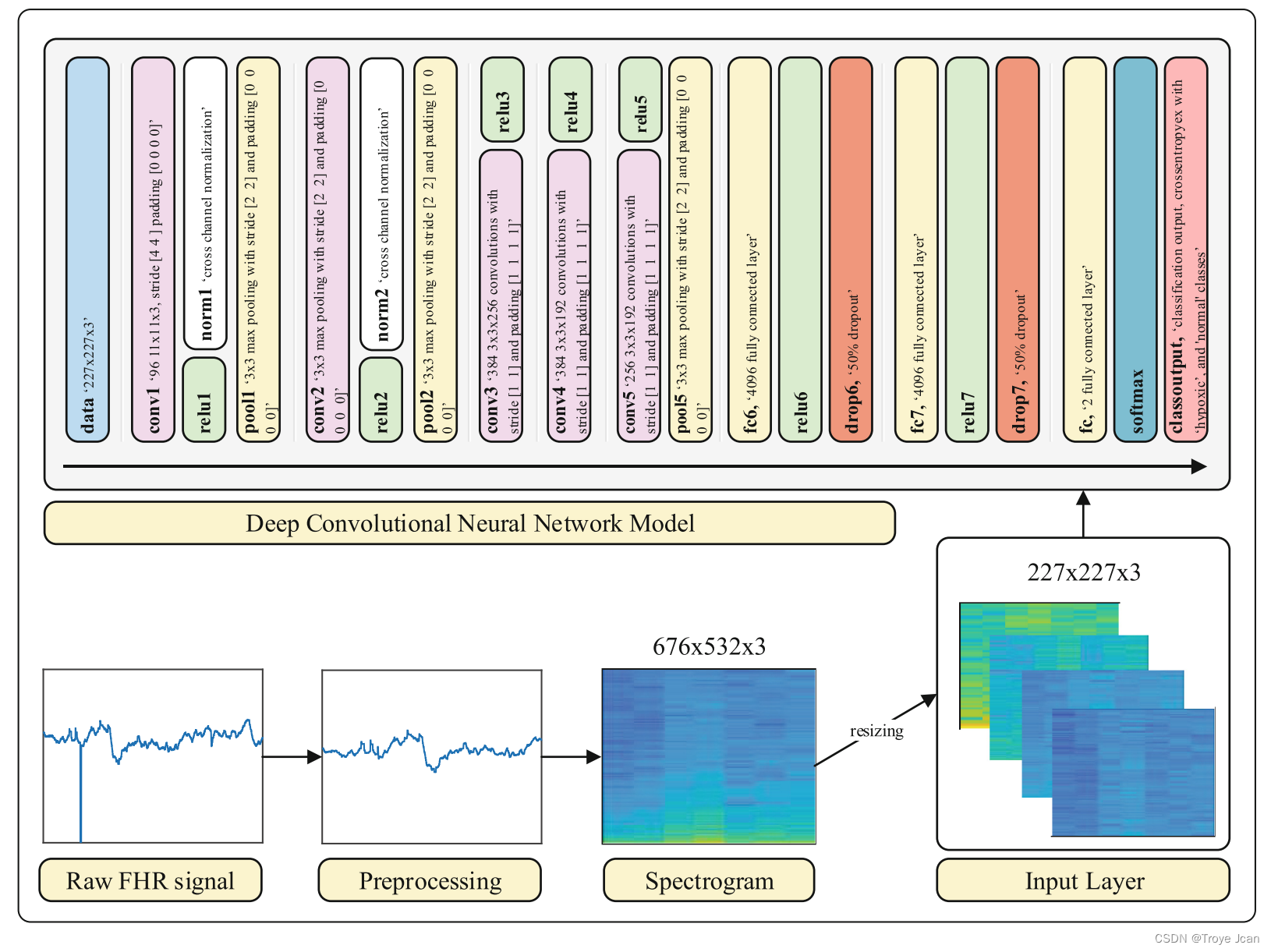 #论文阅读CTG Fetal Hypoxia Detection Based on Deep Convolutional Neural Network with Transfer Learning