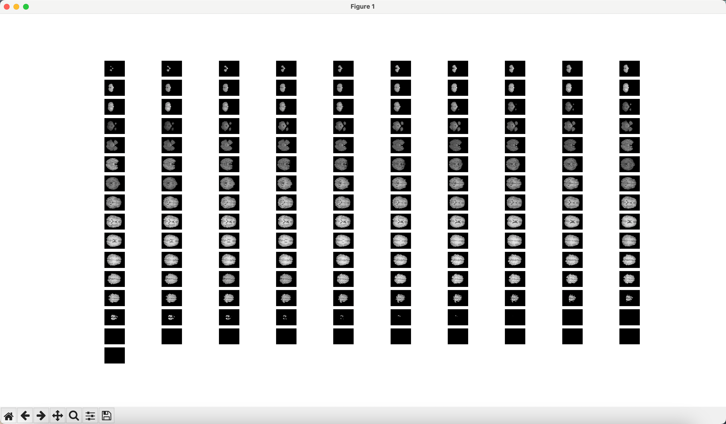 医学图像 ABIDE 等数据集 .nii.gz Python格式化显示