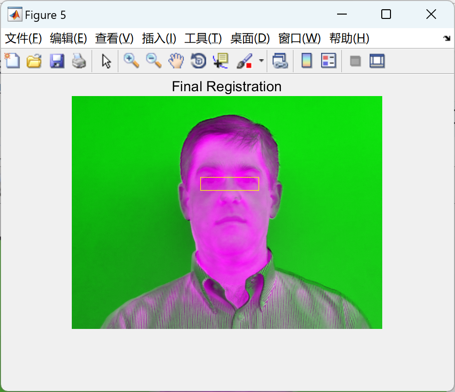 【图像处理】图像配准、图像增强和图像分割研究（Matlab代码实现）
