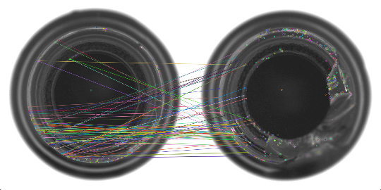 【论文阅读 07】Anomaly region detection and localization in metal surface inspection