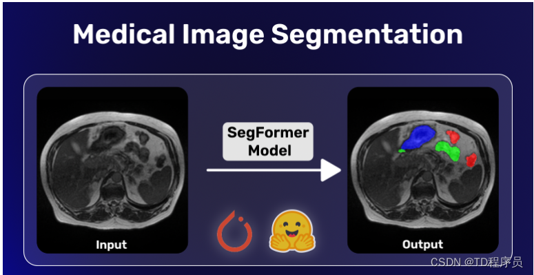 详细介绍如何使用HuggingFace和PyTorch进行医学图像分割-附源码
