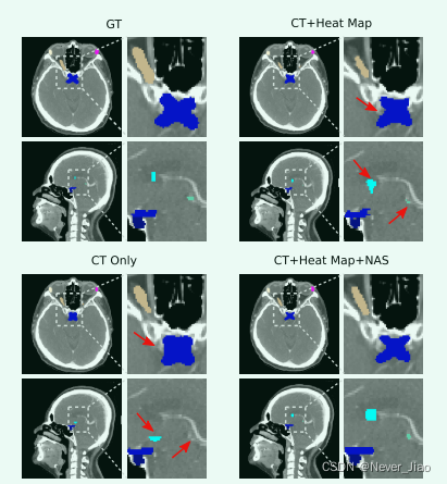 Fig.4