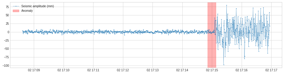 Common algorithms and cases of abnormal value detection - Programmer Sought