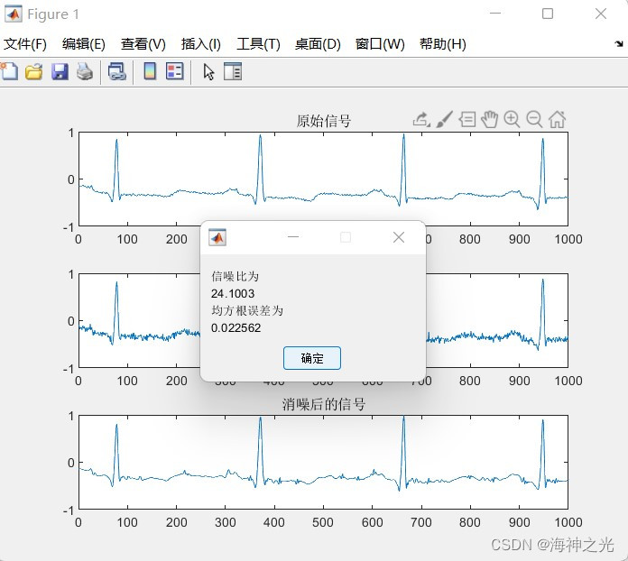 【心电信号】小波阙值心电信号去噪【含Matlab源码 2188期】