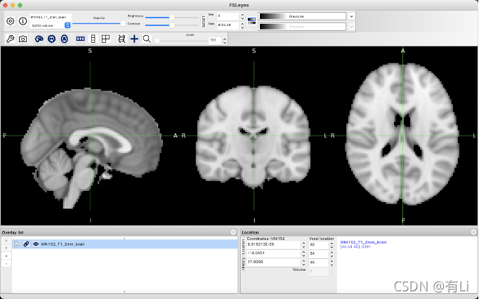 Fsl Object Model Li‘s 核磁共振影像数据处理-20-FSL数学工具fslmaths_erode by zeroing non-zero voxels ...