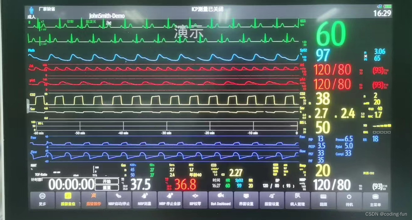 迈瑞BeneVision N17/N15/N12协议解析