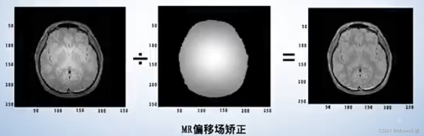 医学影像处理----课程学习笔记_ct成像文件是位图还是矢量图-CSDN博客