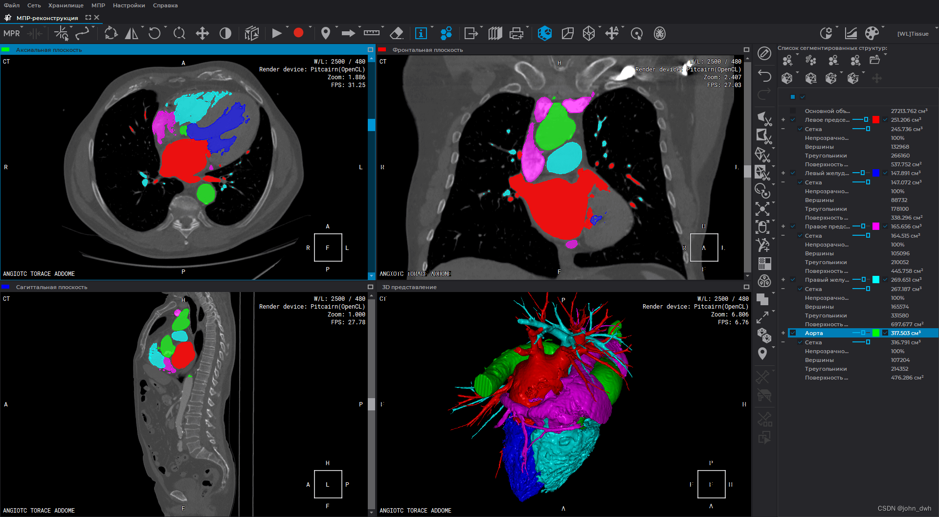 Inobitec DICOM Viewer Pro 2.8.0 Crack