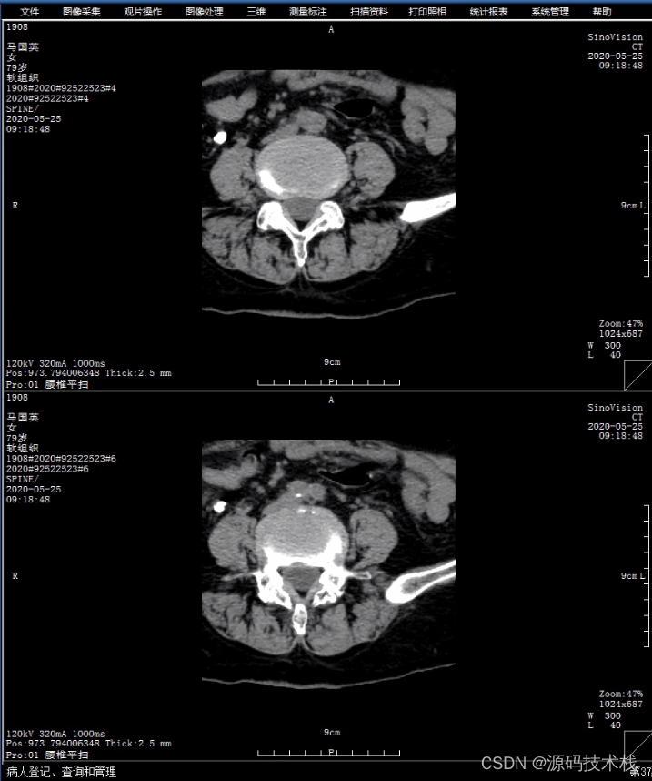 医学影像PACS源码：PACS系统的基础知识（DICOM、HL7、SWF）