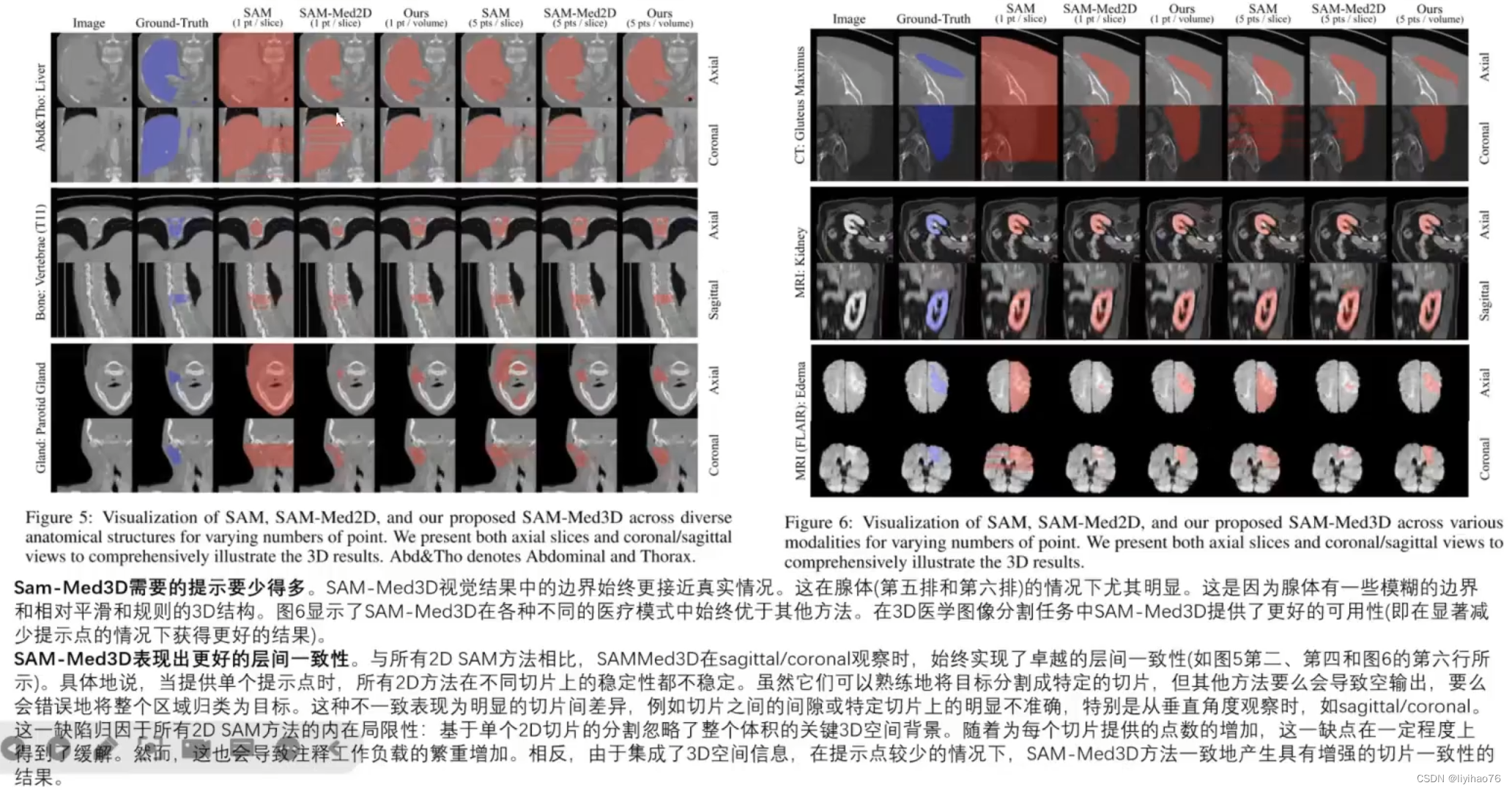 [医学分割大模型系列] (3) SAM-Med3D 分割大模型详解