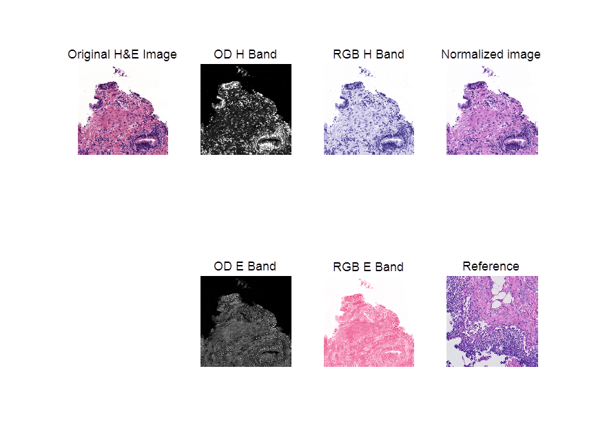 MATLAB环境下基于变分贝叶斯的组织学病理图像颜色盲反卷积方法
