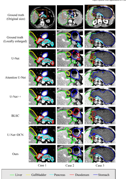 【论文阅读笔记】Multi-organ segmentation network for abdominal CT images based ...