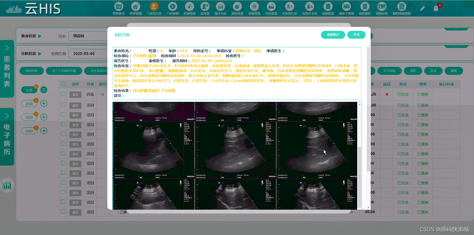 B/S架构云端SaaS服务的医院云HIS系统源码，自主研发，支持电子病历4级