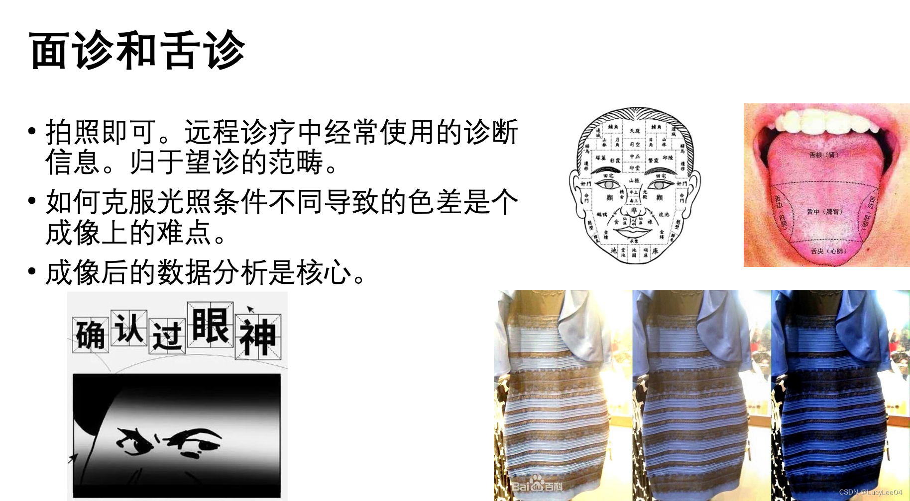 《医学图像处理》第2章——医学成像技术