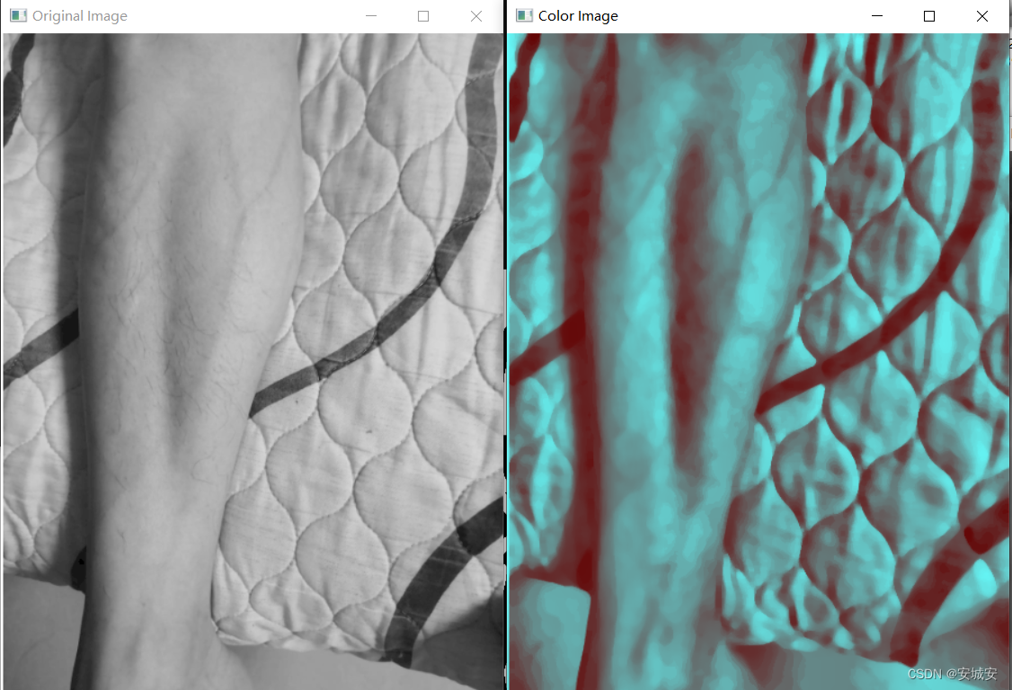 python识别增强静脉清晰度 opencv-python图像处理案例
