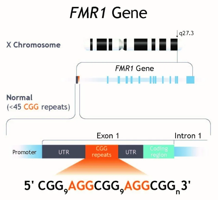 基因检测2 - 脆性X综合征