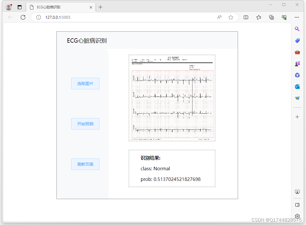 深度学习之基于Vgg16卷积神经网络心电图心脏病诊断系统