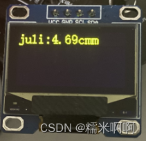 STM3定时器输入捕获、超声波测距