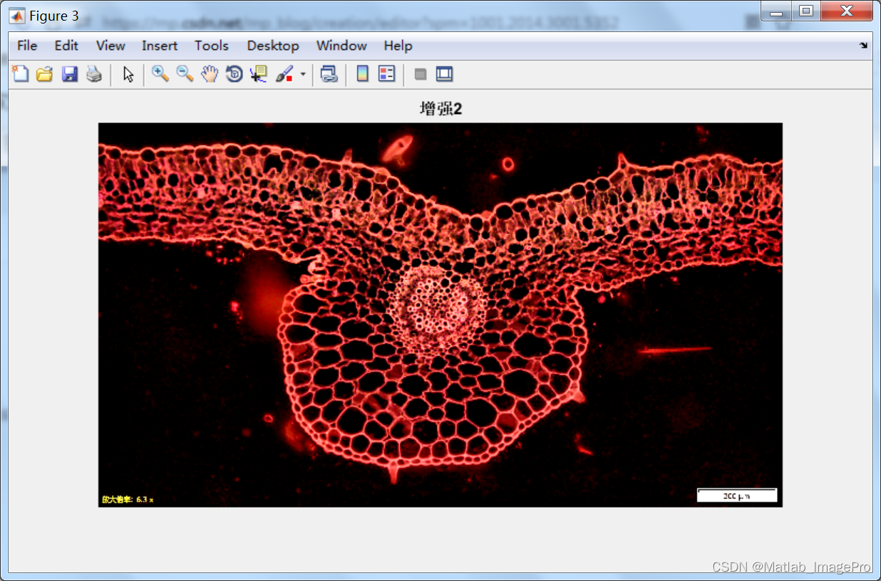 基于Matlab的血管图像增强算法，Matlab实现
