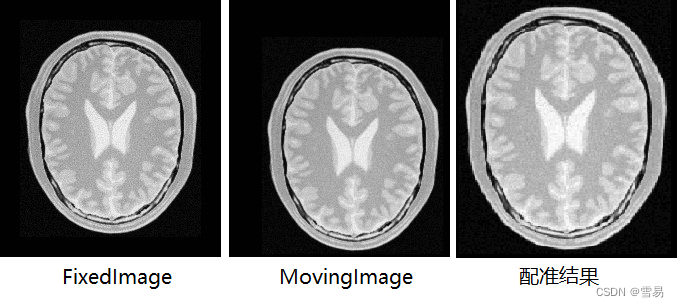 【ITK配准】第九期 基匹配Metric的配准样例