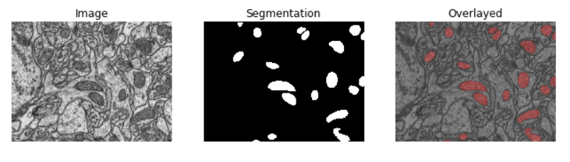 使用影像组学协助医学图像和生物图像的2d、3d分割_original shape features 组学-CSDN博客