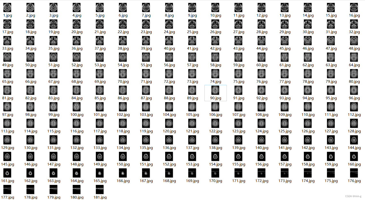 MTLAB 批量下载 脑医学图像数据集BrainWeb: Simulated Brain Database