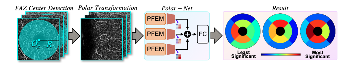Polar-Net：通过 OCTA（光学相干断层扫描血管成像）检测阿尔茨海默病