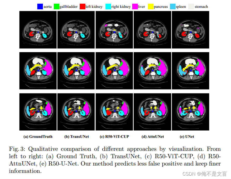 论文研读：Transformers Make Strong Encoders for Medical Image Segmentation