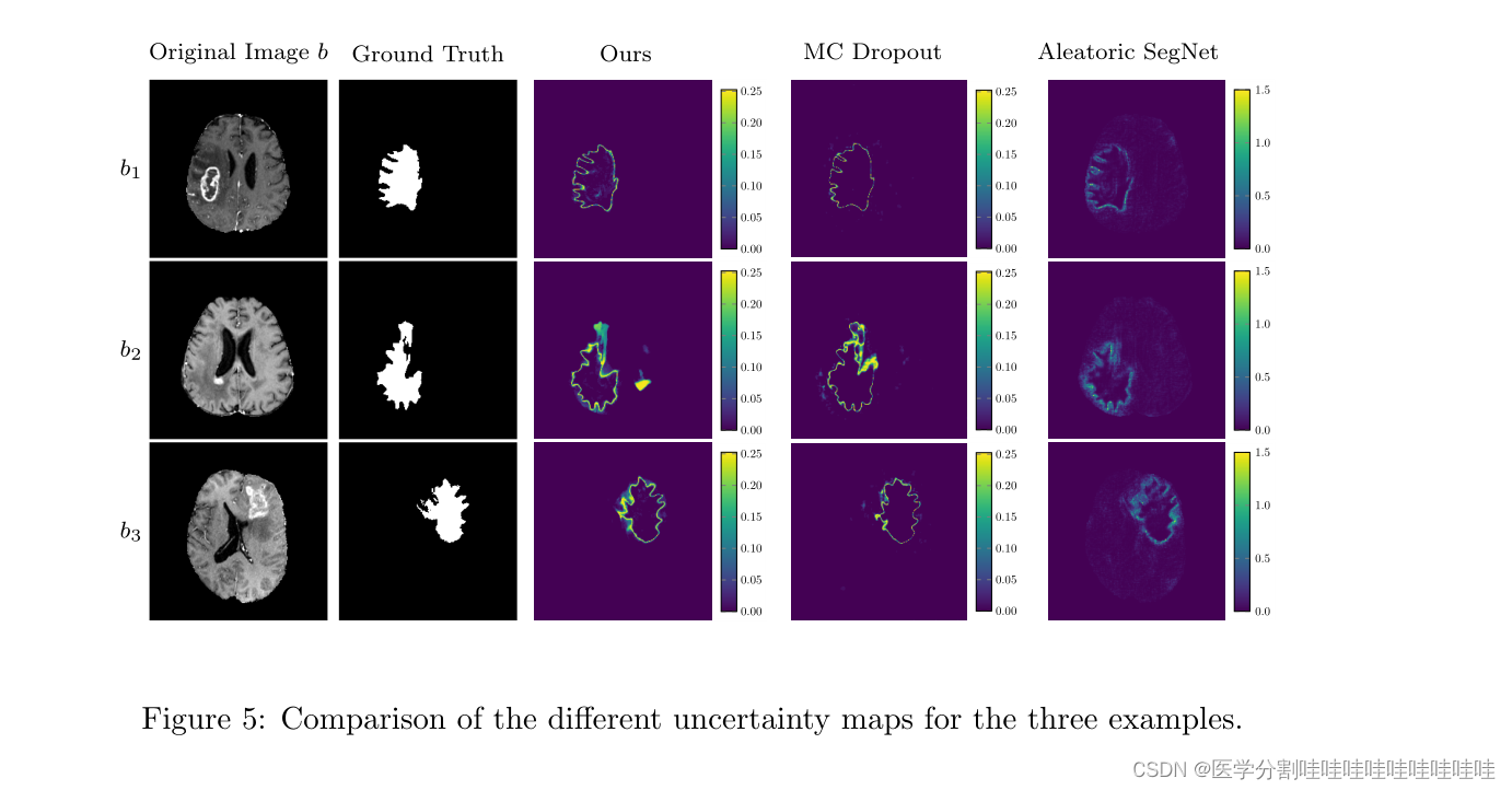 Diffusion Models for Implicit Image Segmentation Ensembles