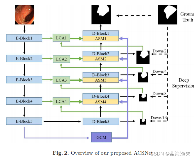 图像分割论文阅读：Adaptive Context Selection for Polyp Segmentation