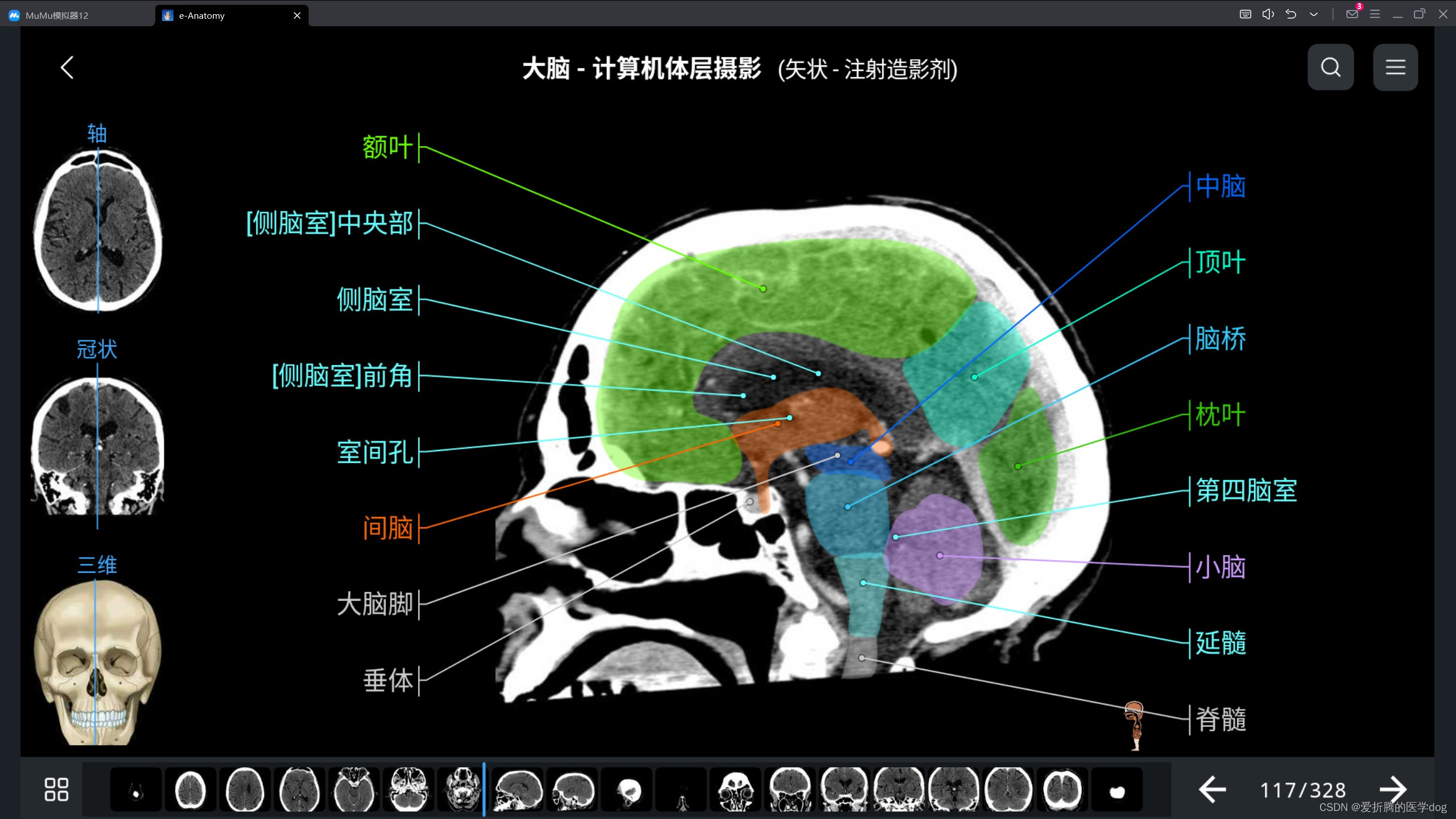 最新中文版e-anatomy解锁版