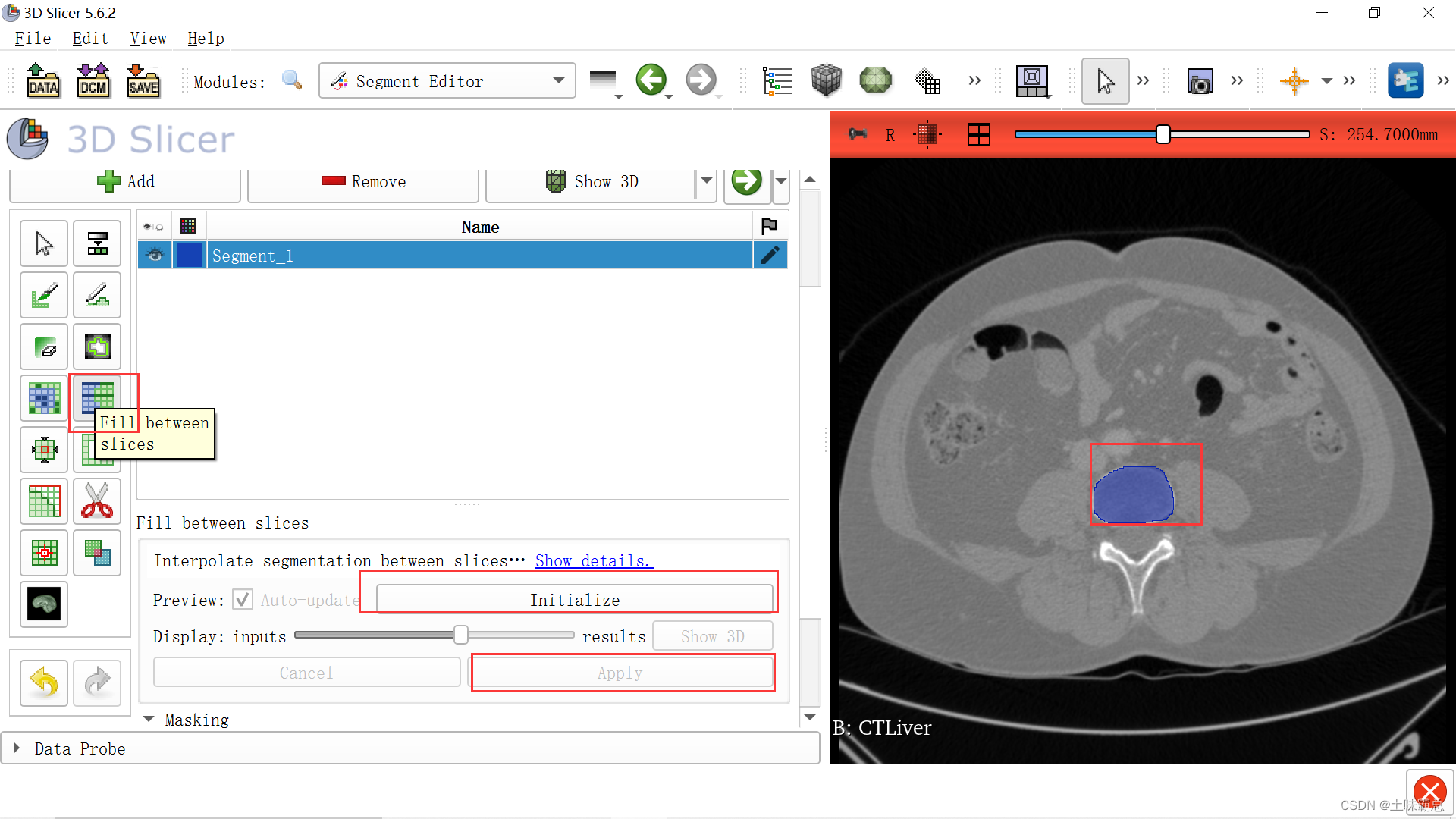 3D Slicer的学习（二） 图像的分割_3dslicer裁剪-CSDN博客