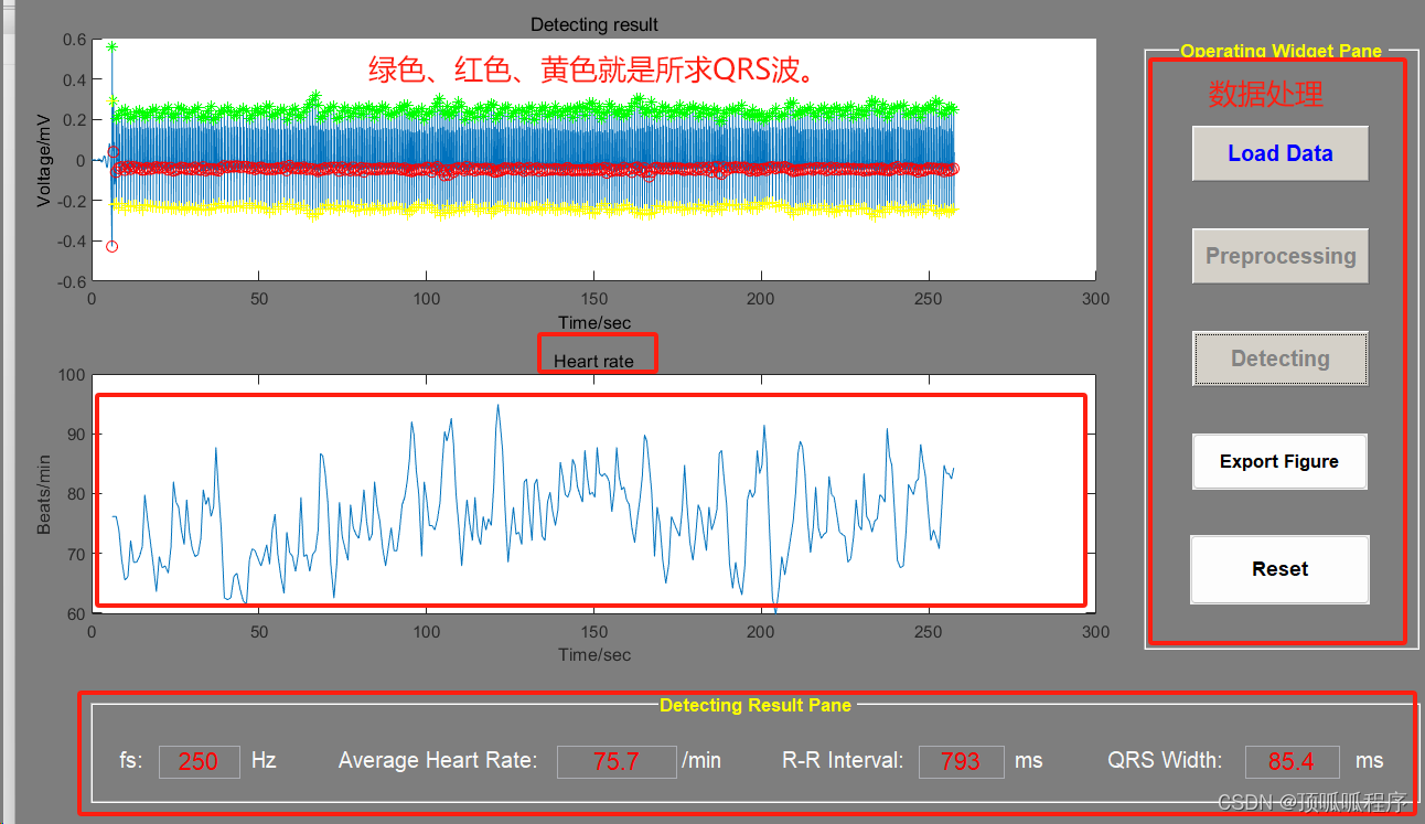 252 基于MATLAB的自适应差分阈值法检测心电信号的QRS波