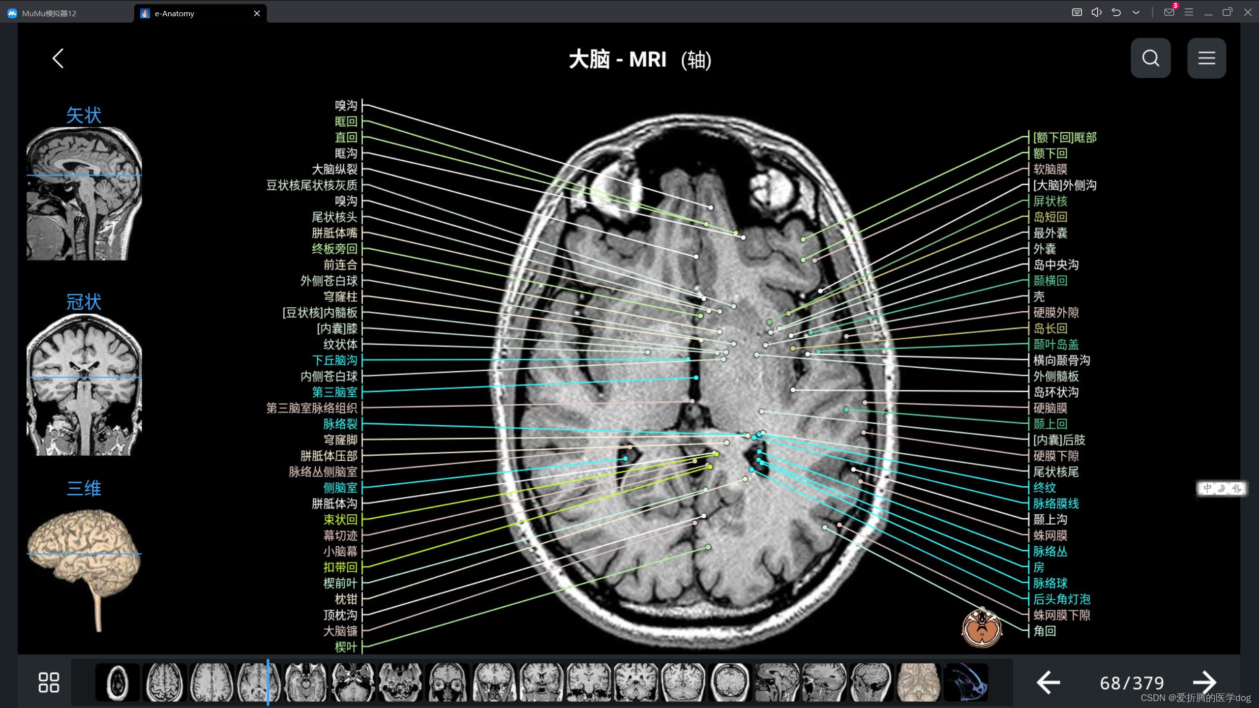 最新中文版e-anatomy解锁版