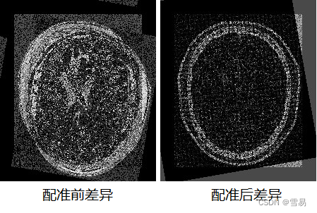 【ITK配准】第十一期 空间对象的模糊构建配准样例