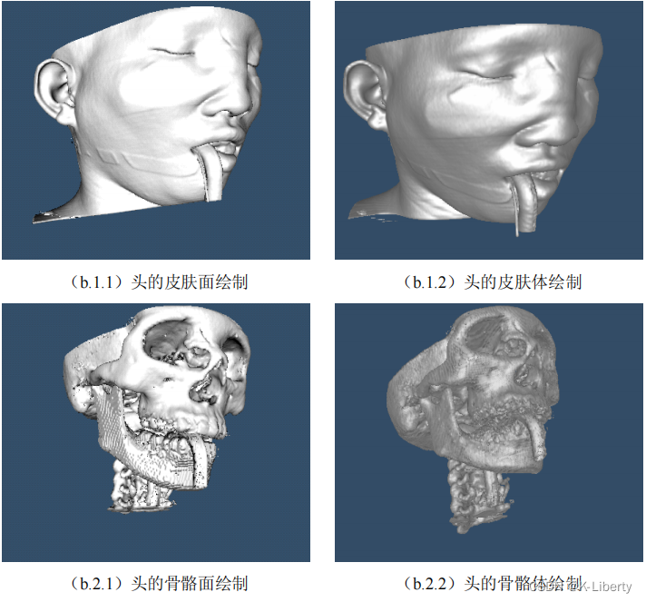 VTK- 面绘制体绘制